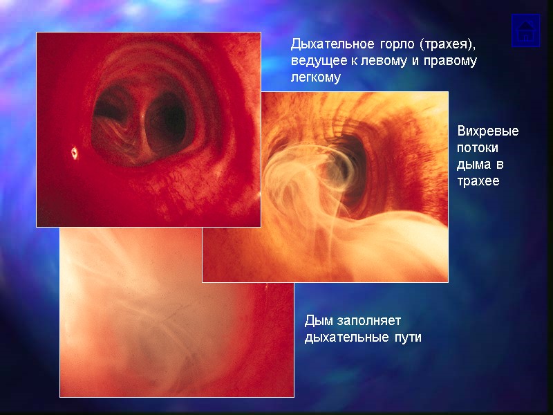 Дыхательное горло (трахея), ведущее к левому и правому легкому Дым заполняет дыхательные пути Вихревые